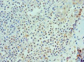 IL21 antibody