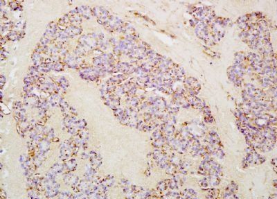 IL21 Rabbit Polyclonal Antibody