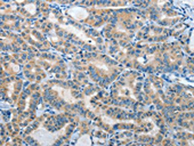 IL21R Antibody
