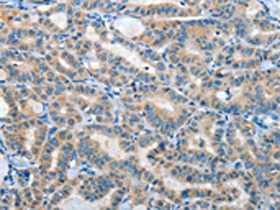 IL21R antibody