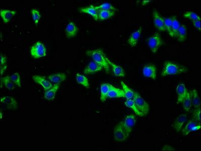 IL22RA1 antibody