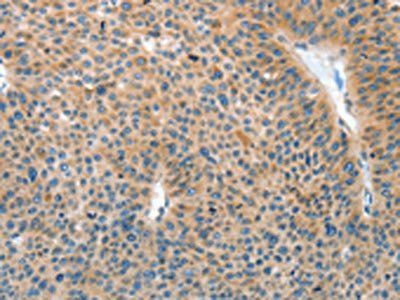 IL22RA1 Antibody