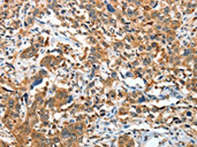 IL22RA1 Antibody