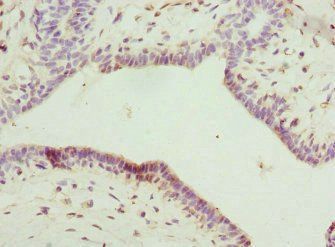 IL22RA2 antibody