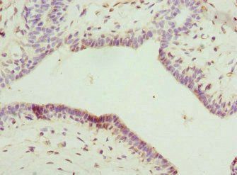 IL22RA2 Antibody