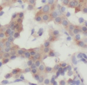 IL23A antibody