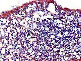 IL23R Antibody