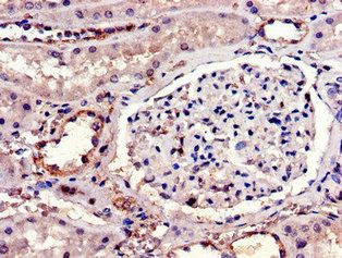 IL23R Antibody