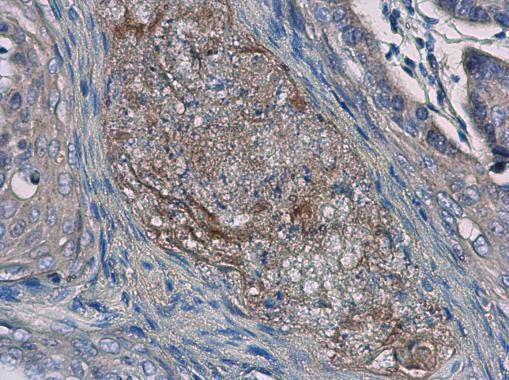 IL24 antibody [C2C3], C-term