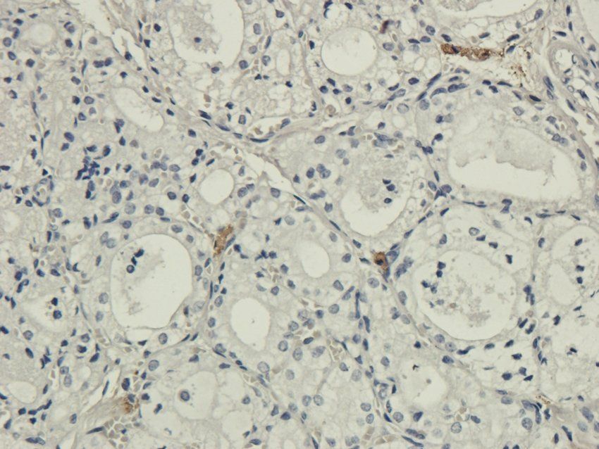 IL26 antibody