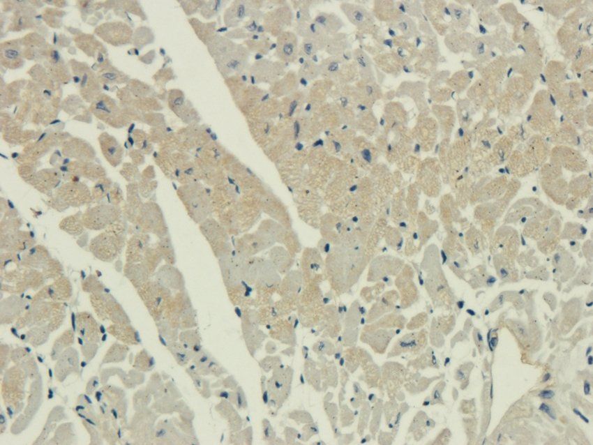 IL26 antibody