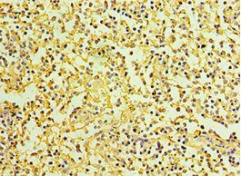 IL27RA Antibody