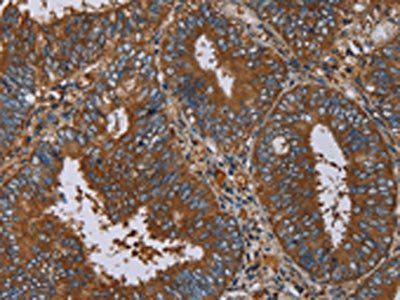IL27RA Antibody