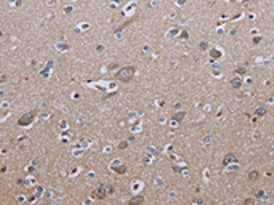IL27RA Antibody