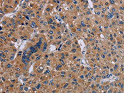 IL27RA Antibody