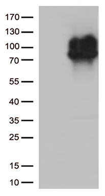 IL28 Receptor alpha Antibody