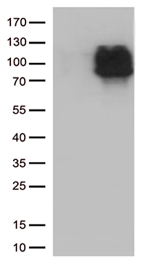 IL28 Receptor alpha Antibody
