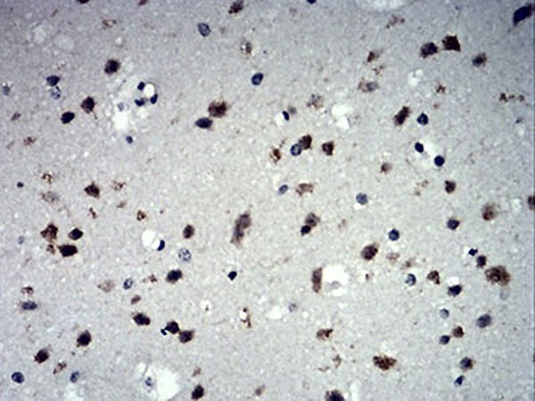 IL28A Antibody