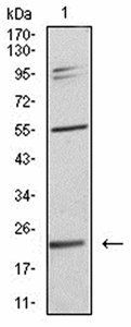 IL28A Antibody