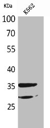 IL2RA Antibody