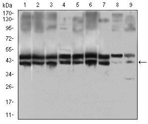 IL2RA Antibody