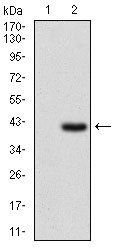 IL2RA Antibody