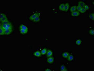 IL2RA Antibody