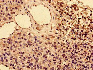 IL2RA Antibody