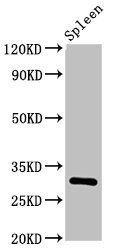 IL2RA Antibody