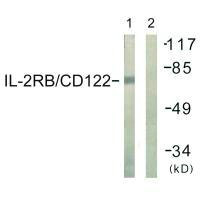 IL2RB (Ab-364) Antibody