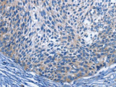 IL2RB Antibody