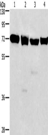 IL2RB antibody
