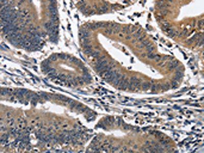 IL2RB Antibody