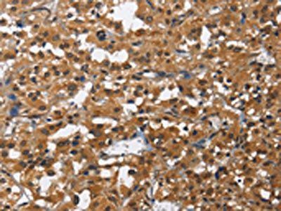 IL2RB Antibody