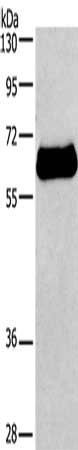 IL2RB Antibody