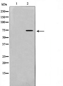 IL2RB Antibody