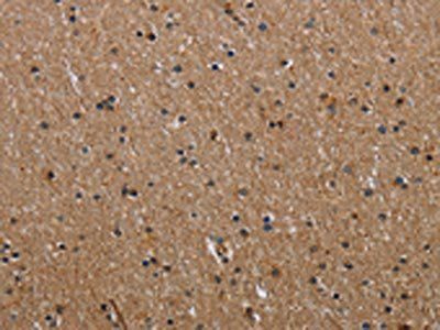 IL2RG Antibody