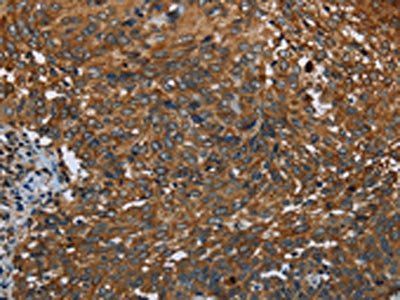 IL2RG Antibody