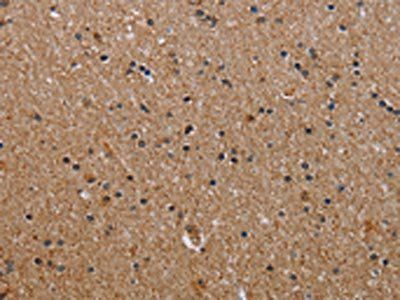 IL2RG Antibody