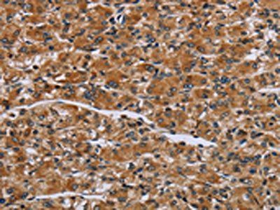 IL2RG Antibody