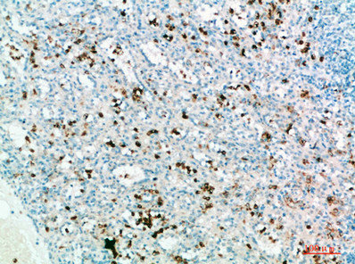 IL31 antibody