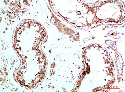 IL31 antibody