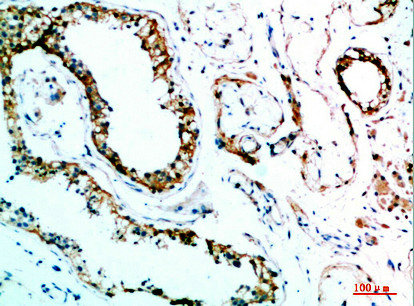 IL31 antibody