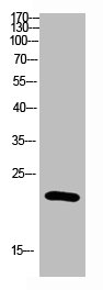 IL31 antibody