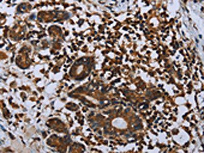 IL31RA Antibody