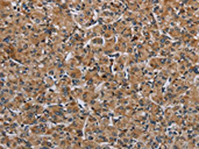 IL31RA Antibody