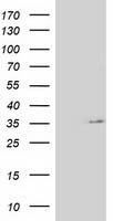 IL1F6 Antibody
