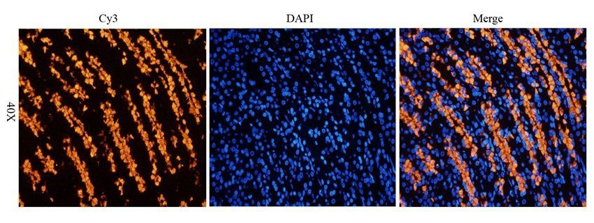 IL36 gamma antibody