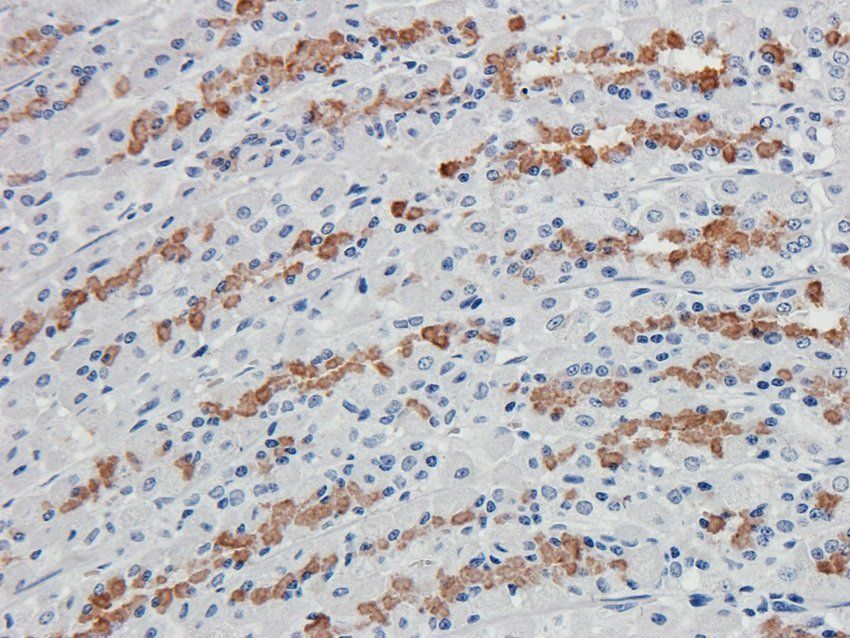 IL36 gamma antibody