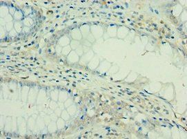 IL36RN Antibody